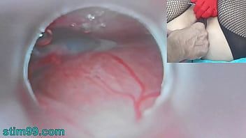 Play Uncensored Japanese Insemination with Cum into Uterus and Endoscope Camera by Cervix to watch inside womb